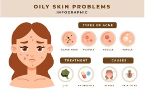 نکات جلوگیری از جوش زدن صورت و بدن - مشکلات پوست های چرب